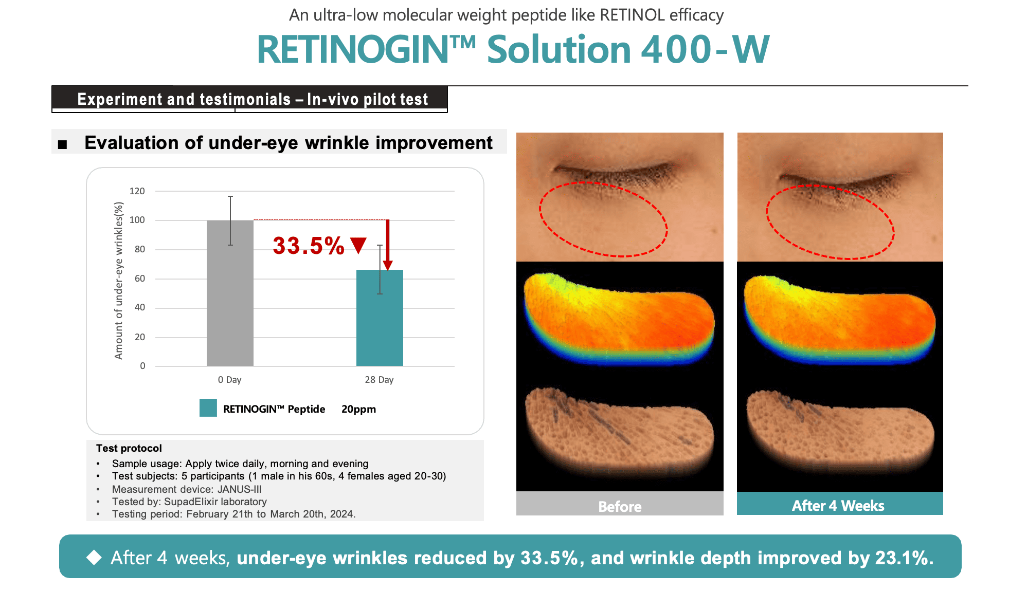 Under-eye Wrinkle Results